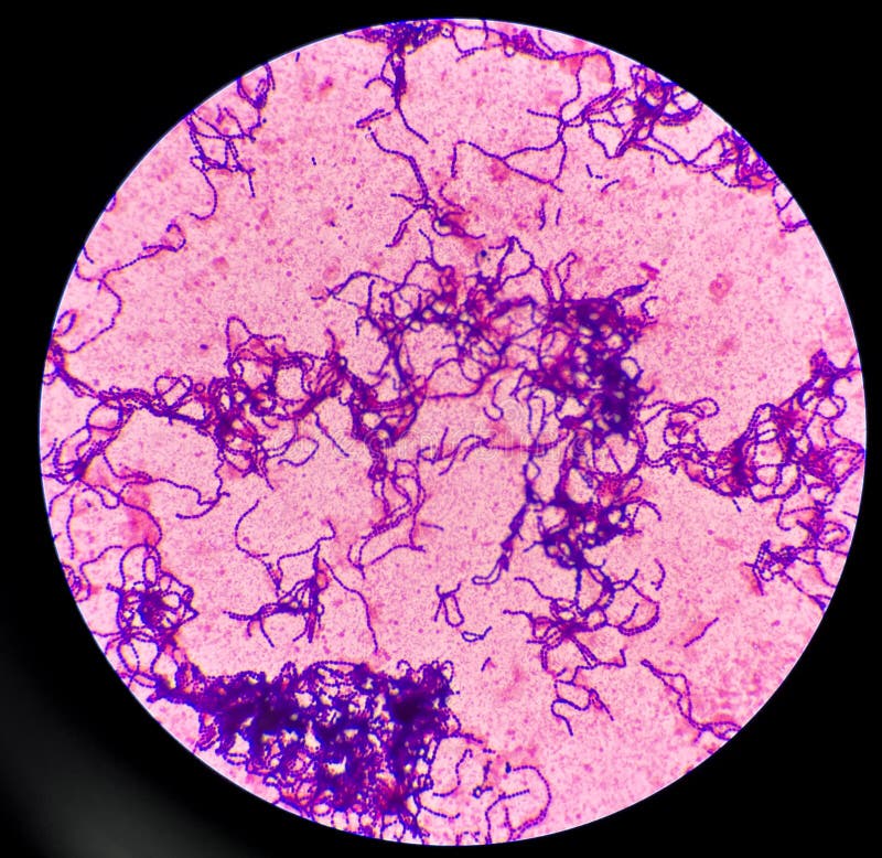 Gram Positive Cocci In Chain Stock Photo Image Of Culture Cocci