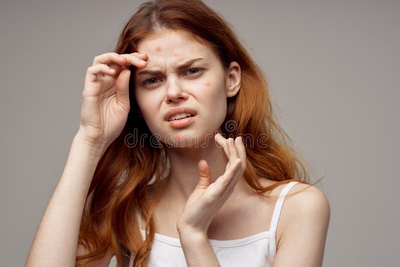 Pretty Woman Facial Skin Problems Dermatology Close Up Stock Photo