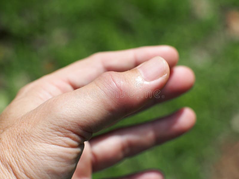 This is What Rheumatoid Arthritis Looks Like forecast This is What Rheumatoid Arthritis Looks Like forecast