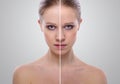 Effect of healing of skin, beauty young woman