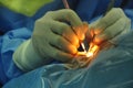 Eye Surgery Cataract