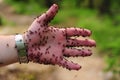 Man's hand with ants