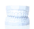 Plaster cast of perfect teeth