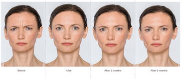 Como arreglar las ojeras el modo público