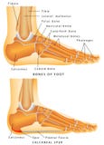 Posterior Calcaneal Spur