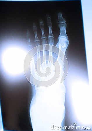 Abstract foot X ray