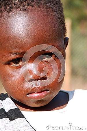 African children suffering from AIDS virus in the Village of Pom