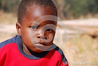 African children suffering from AIDS virus in the Village of Pom