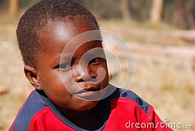 African children suffering from AIDS virus in the Village of Pom