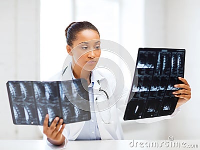 African doctor looking at x-rays