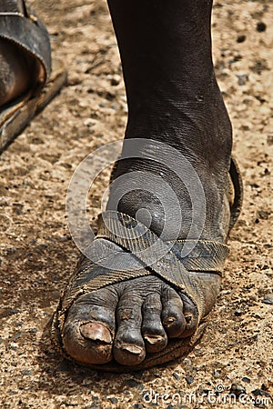African foot