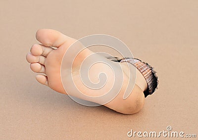 Bare sole of right foot