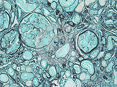 Basement Membrane of a Kidney