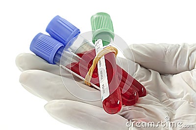 Blood specimen - Medical analysis