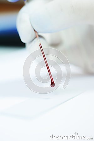 Blood testing in laboratory