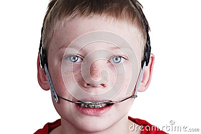 boy-braces-headgear-29173052.jpg