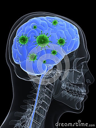 brain infection bacteria rendered ray human head 3d illustration