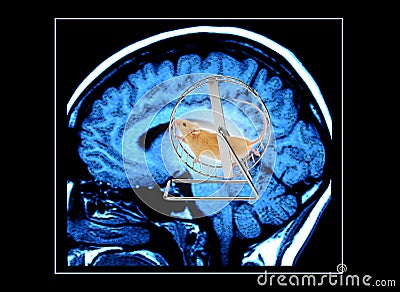 Brain MRI Scan Stress
