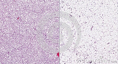 Brown (left) and white (right) fat