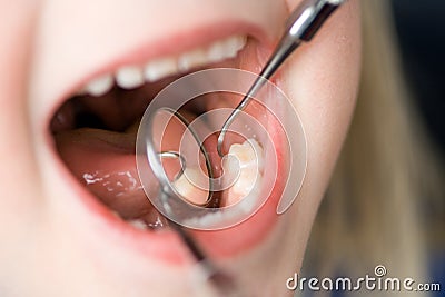 Child Dental Check-Up