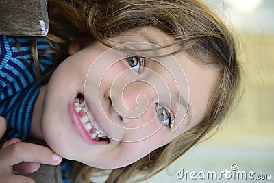 Child with missing teeth smiling