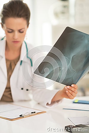 Closeup on medical doctor woman with fluorography