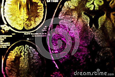 Colorful MRI of brain