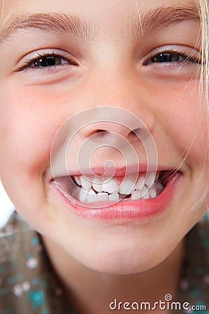 Dental gap
