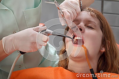 Dental procedure, splashing tooth