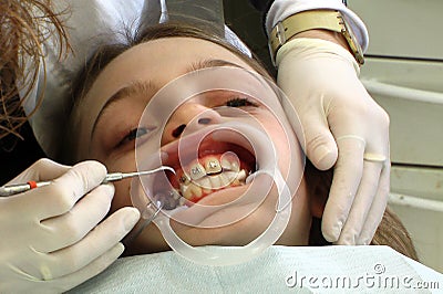 Dental treatment