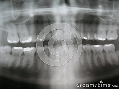 Dental X-ray