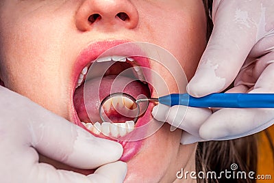 Dentist checking pacient s teeth
