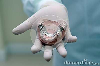 Denture in dentist hand.