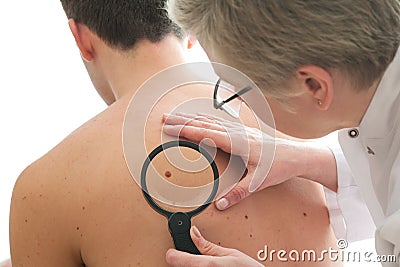 Dermatologist examines a mole