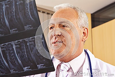 Doctor looking at x-ray image of spine