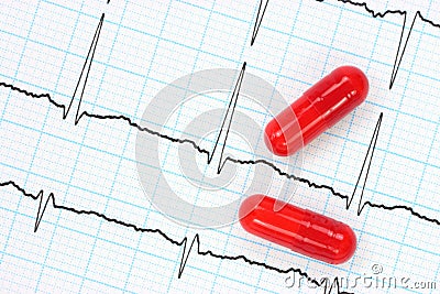 Electrocardiogram and capsules