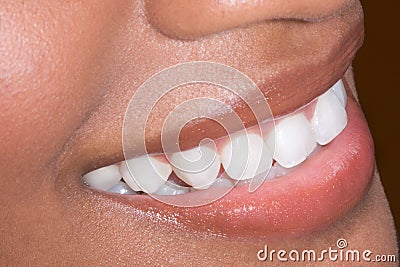 Ethnic black African-American woman teeth closeup