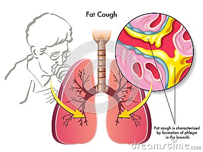 Fat Cough Royalty Free Stock Photography - Image: 28713027