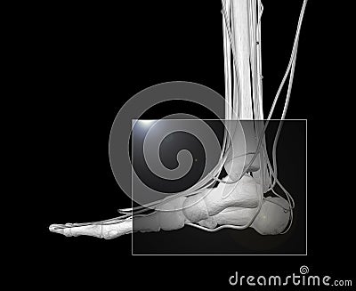 Foot X-ray