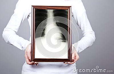 Girl keep frame with x-ray inside.