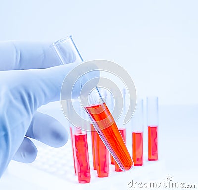 Hand in medical blue glove is holding test tube with red liquid in laboratory