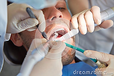 Hands of dentist at dental treatment