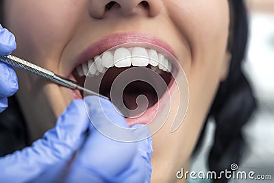 Healthy Female Teeth