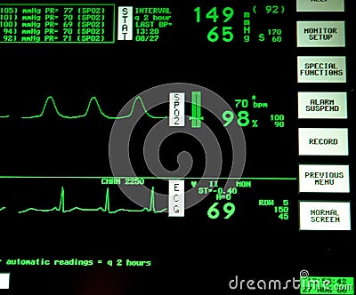 Heart Monitor