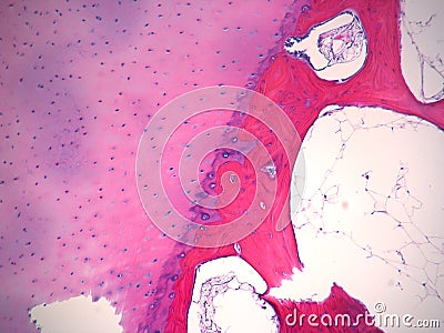 Histology Bone stained H&E