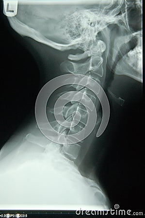 Human neck x-ray