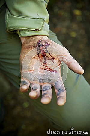 Injured Hand Cut Blood