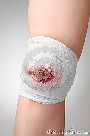 Injured knee with bloody bandage