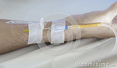 iv在耐心胳膊的针医学射入的图片