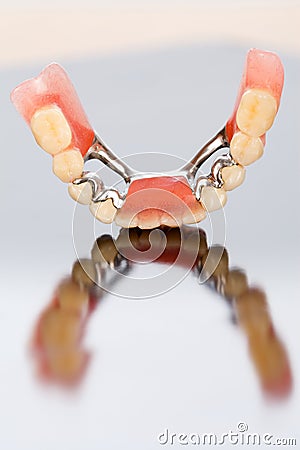 Lower dental prosthesis with ceramic